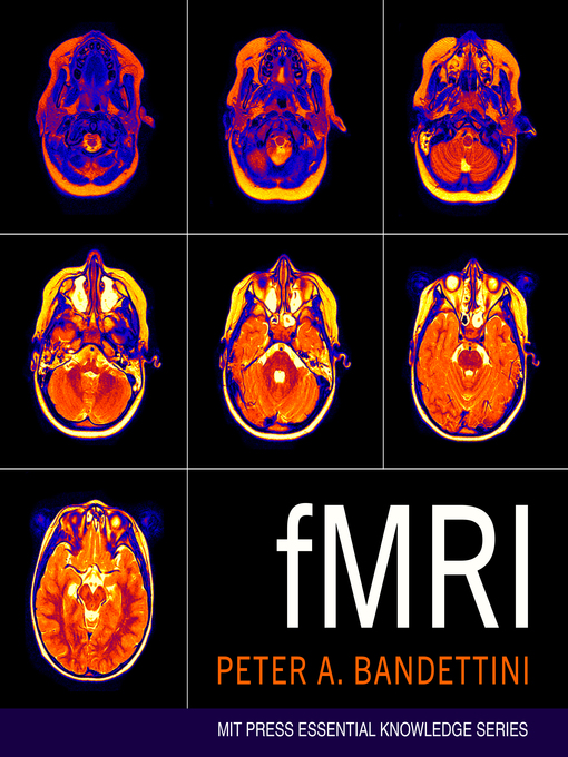 Title details for fMRI by Peter A. Bandettini - Available